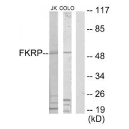 Western blot - FKRP Antibody from Signalway Antibody (34068) - Antibodies.com