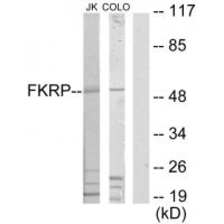 Western blot - FKRP Antibody from Signalway Antibody (34068) - Antibodies.com