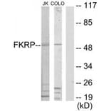 Western blot - FKRP Antibody from Signalway Antibody (34068) - Antibodies.com