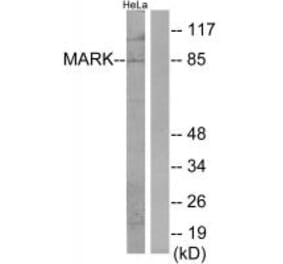 Western blot - MARK Antibody from Signalway Antibody (34087) - Antibodies.com