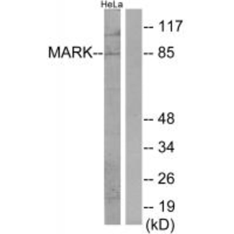 Western blot - MARK Antibody from Signalway Antibody (34087) - Antibodies.com
