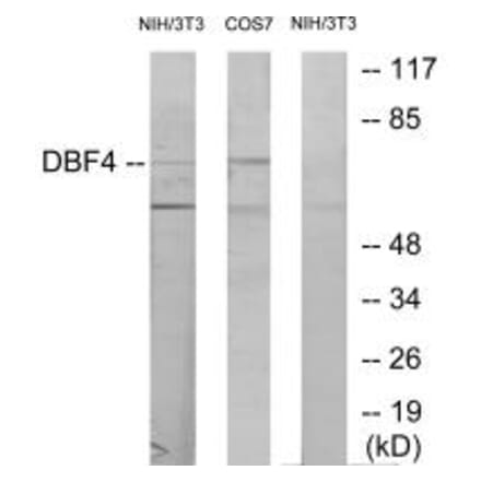 Western blot - DBF4 Antibody from Signalway Antibody (34095) - Antibodies.com