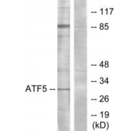 Western blot - ATF5 Antibody from Signalway Antibody (34127) - Antibodies.com