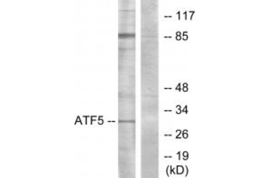 Western blot - ATF5 Antibody from Signalway Antibody (34127) - Antibodies.com