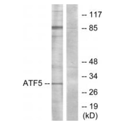 Western blot - ATF5 Antibody from Signalway Antibody (34127) - Antibodies.com