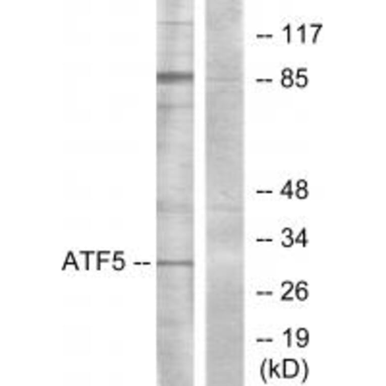 Western blot - ATF5 Antibody from Signalway Antibody (34127) - Antibodies.com