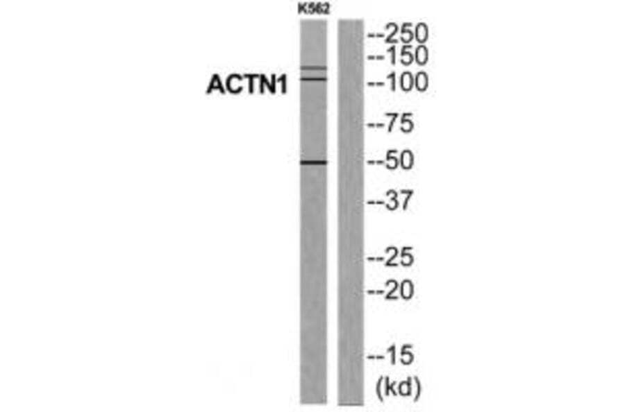 Western blot - ACTN1 Antibody from Signalway Antibody (34156) - Antibodies.com