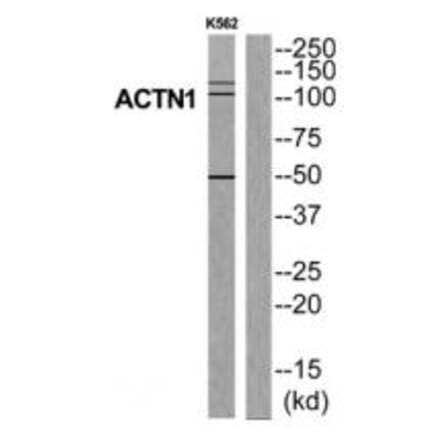 Western blot - ACTN1 Antibody from Signalway Antibody (34156) - Antibodies.com