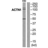 Western blot - ACTN1 Antibody from Signalway Antibody (34156) - Antibodies.com
