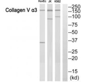 Western blot - ACTN3 Antibody from Signalway Antibody (34157) - Antibodies.com