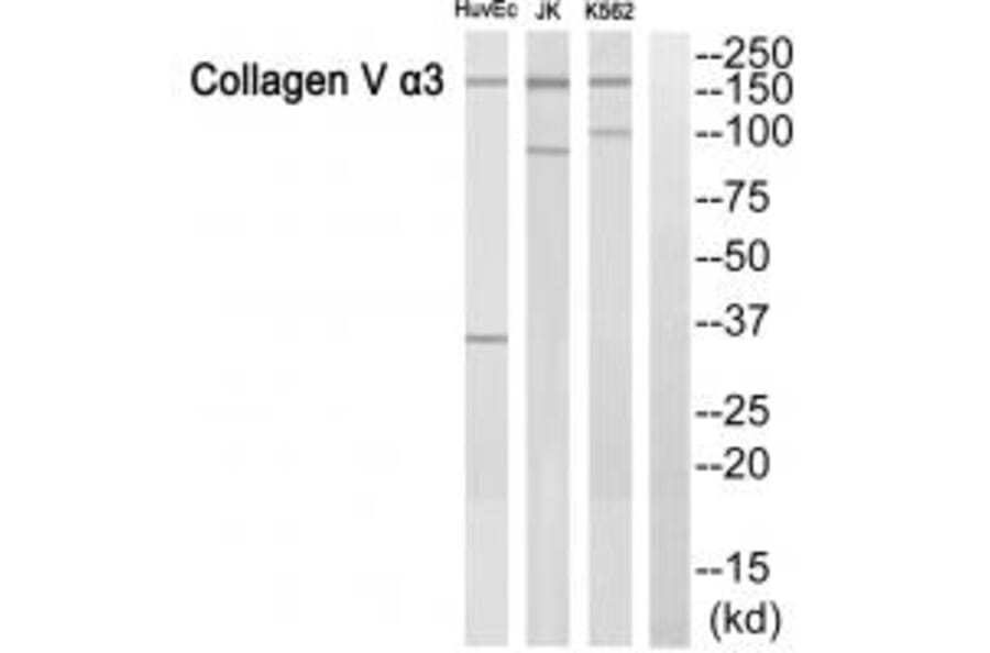 Western blot - ACTN3 Antibody from Signalway Antibody (34157) - Antibodies.com