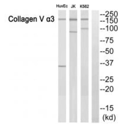 Western blot - ACTN3 Antibody from Signalway Antibody (34157) - Antibodies.com