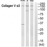 Western blot - ACTN3 Antibody from Signalway Antibody (34157) - Antibodies.com