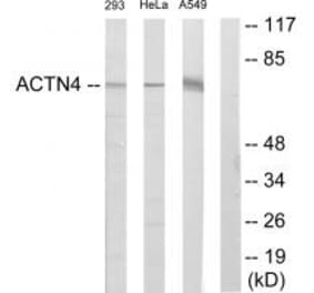 Western blot - ACTN4 Antibody from Signalway Antibody (34158) - Antibodies.com