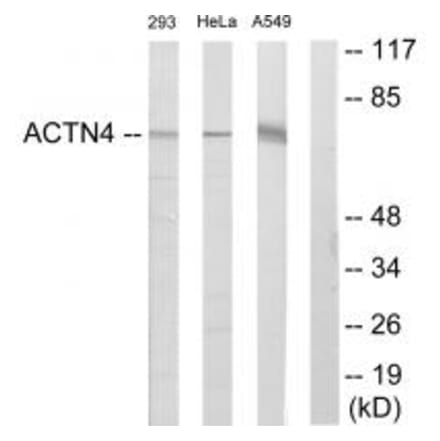 Western blot - ACTN4 Antibody from Signalway Antibody (34158) - Antibodies.com