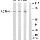 Western blot - ACTN4 Antibody from Signalway Antibody (34158) - Antibodies.com