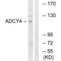 Western blot analysis of extracts from Jurkat cells, using ADCY4 antibody #34160.