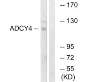 Western blot - ADCY4 Antibody from Signalway Antibody (34160) - Antibodies.com
