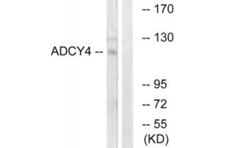 Western blot - ADCY4 Antibody from Signalway Antibody (34160) - Antibodies.com