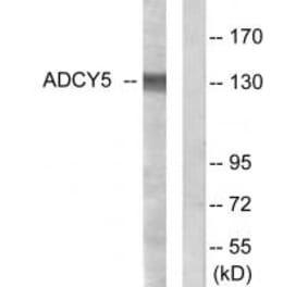 Western blot - ADCY5 Antibody from Signalway Antibody (34161) - Antibodies.com