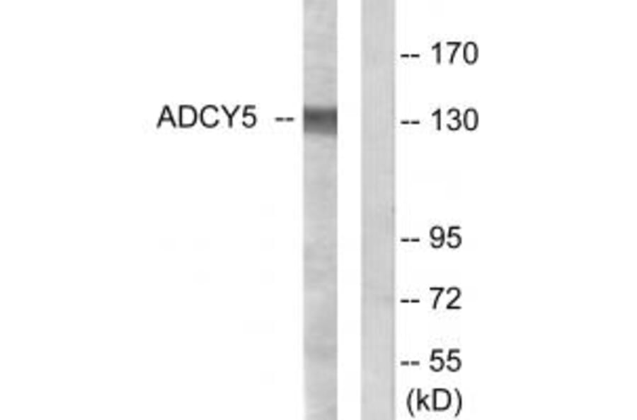 Western blot - ADCY5 Antibody from Signalway Antibody (34161) - Antibodies.com
