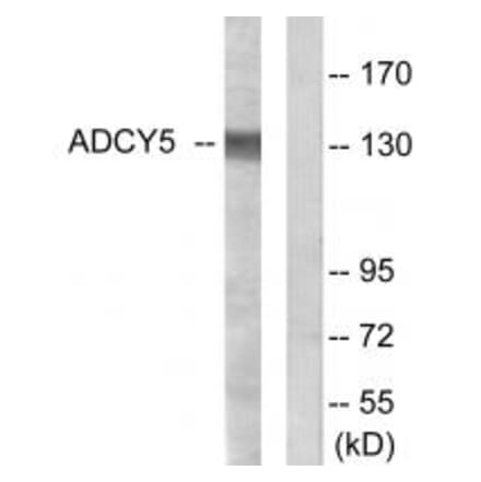 Western blot - ADCY5 Antibody from Signalway Antibody (34161) - Antibodies.com