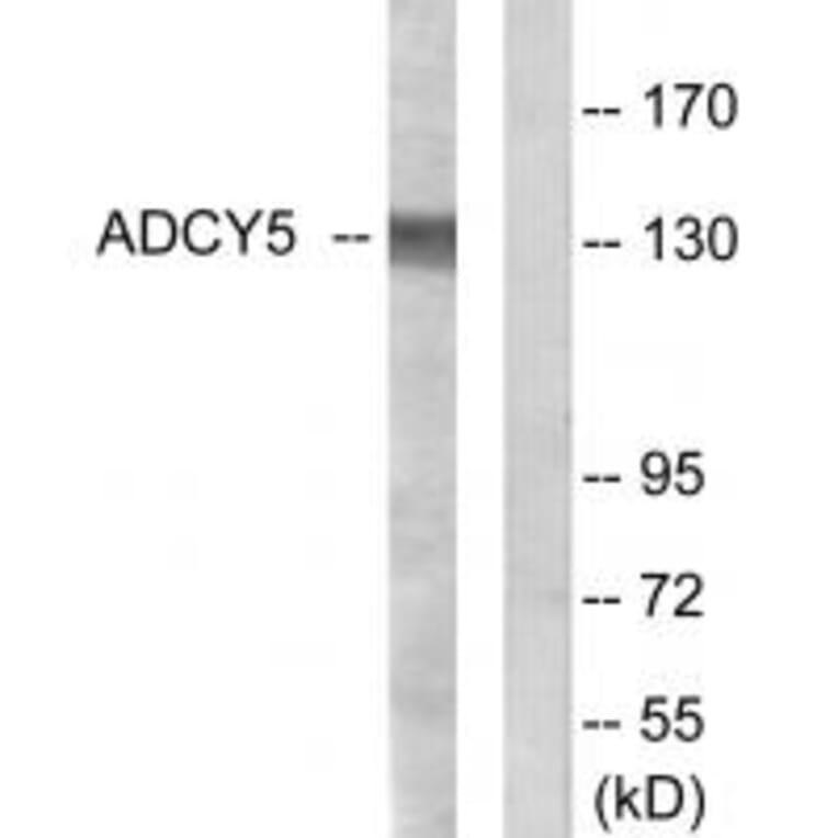Western blot - ADCY5 Antibody from Signalway Antibody (34161) - Antibodies.com