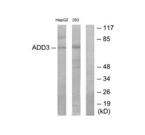 Western blot - ADD3 Antibody from Signalway Antibody (34164) - Antibodies.com