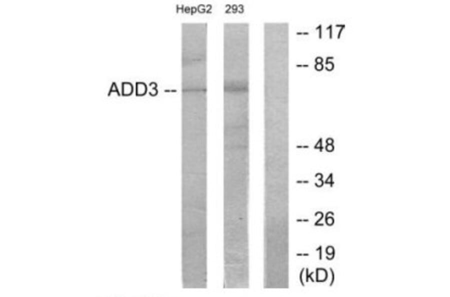 Western blot - ADD3 Antibody from Signalway Antibody (34164) - Antibodies.com