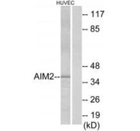 Western blot - AIM2 Antibody from Signalway Antibody (34166) - Antibodies.com
