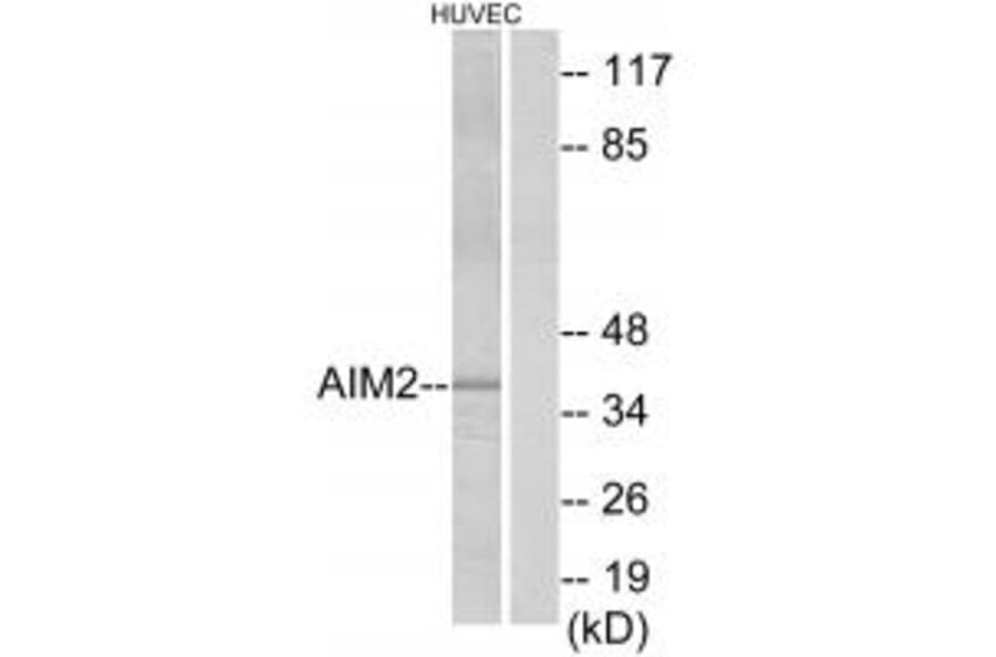Western blot - AIM2 Antibody from Signalway Antibody (34166) - Antibodies.com