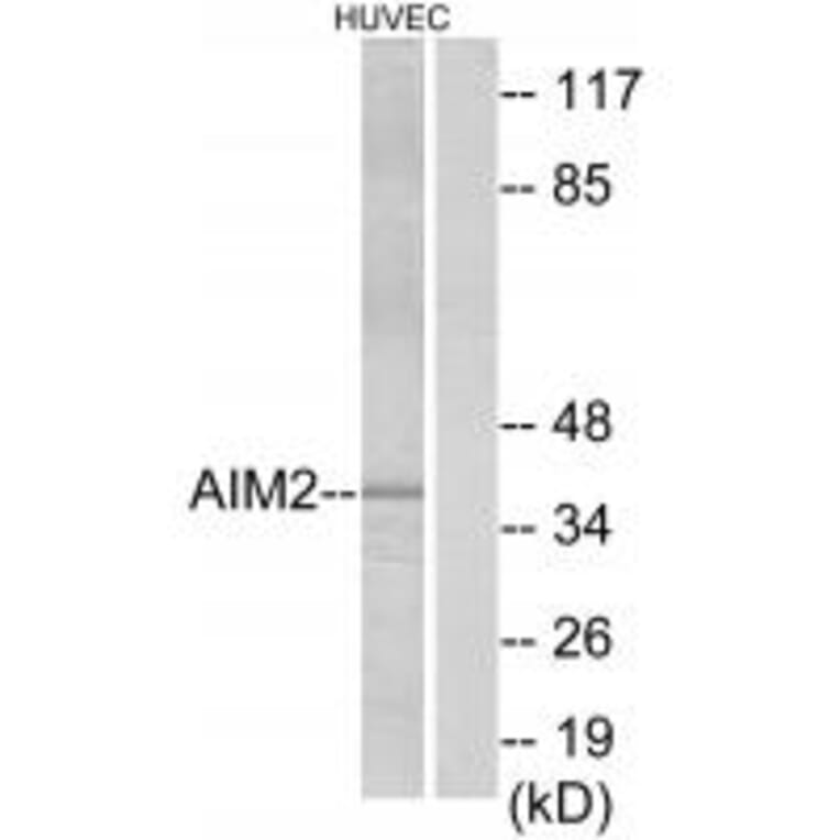 Western blot - AIM2 Antibody from Signalway Antibody (34166) - Antibodies.com