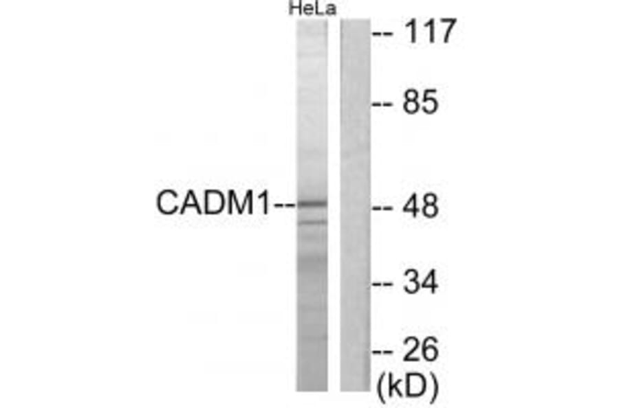 Western blot - CADM1 Antibody from Signalway Antibody (34181) - Antibodies.com