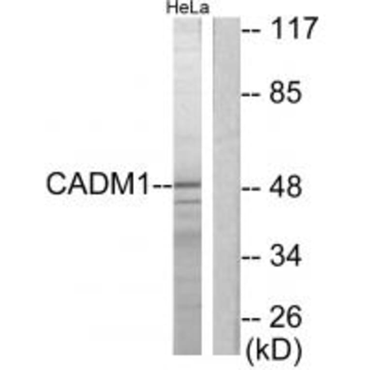 Western blot - CADM1 Antibody from Signalway Antibody (34181) - Antibodies.com