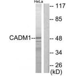 Western blot - CADM1 Antibody from Signalway Antibody (34181) - Antibodies.com