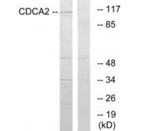 Western blot - CDCA2 Antibody from Signalway Antibody (34192) - Antibodies.com