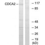 Western blot - CDCA2 Antibody from Signalway Antibody (34192) - Antibodies.com