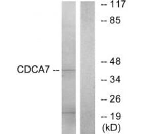 Western blot - CDCA7 Antibody from Signalway Antibody (34194) - Antibodies.com