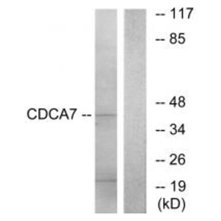 Western blot - CDCA7 Antibody from Signalway Antibody (34194) - Antibodies.com