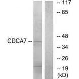 Western blot - CDCA7 Antibody from Signalway Antibody (34194) - Antibodies.com