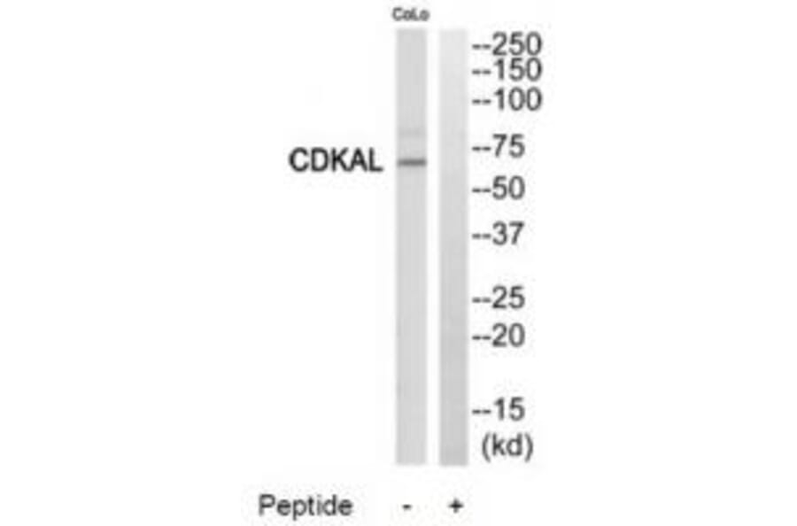 Western blot - CDKAL Antibody from Signalway Antibody (34195) - Antibodies.com