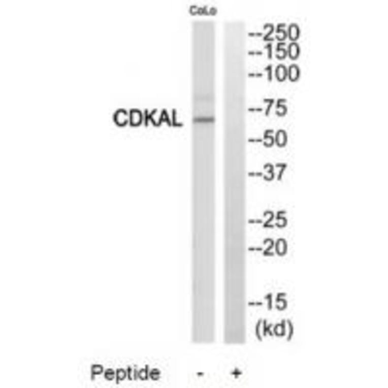 Western blot - CDKAL Antibody from Signalway Antibody (34195) - Antibodies.com