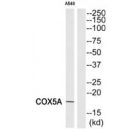 Western blot - COX5A Antibody from Signalway Antibody (34224) - Antibodies.com