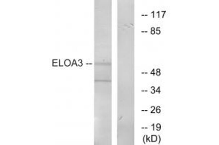 Western blot - ELOA3 Antibody from Signalway Antibody (34268) - Antibodies.com