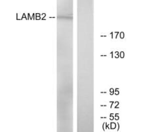 Western blot - LAMB2 Antibody from Signalway Antibody (34277) - Antibodies.com