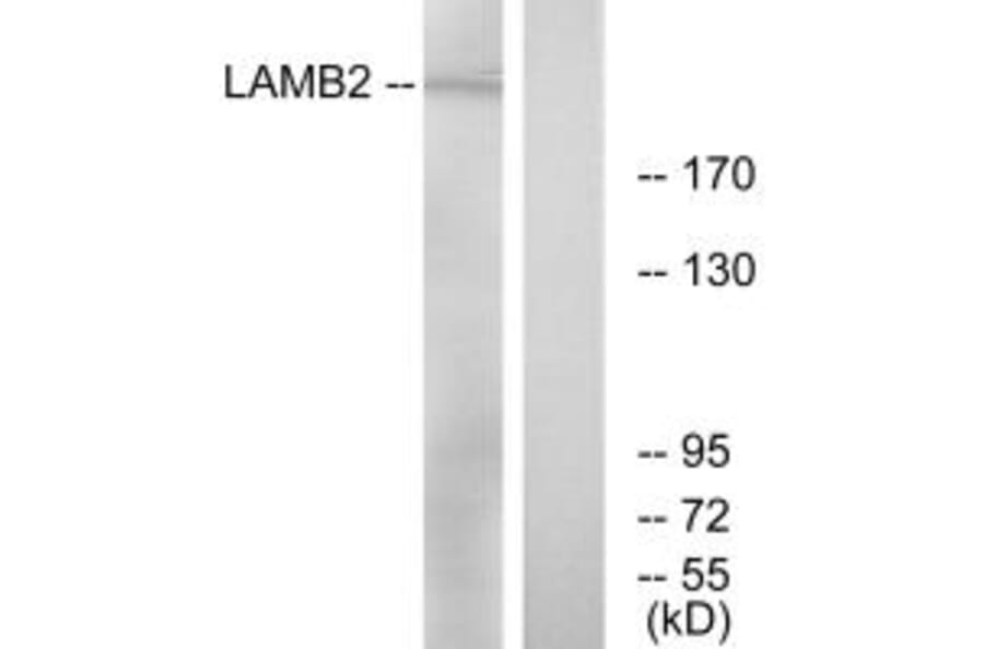 Western blot - LAMB2 Antibody from Signalway Antibody (34277) - Antibodies.com