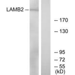 Western blot - LAMB2 Antibody from Signalway Antibody (34277) - Antibodies.com