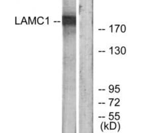 Western blot - LAMC1 Antibody from Signalway Antibody (34279) - Antibodies.com