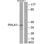 Western blot - PHLA1 Antibody from Signalway Antibody (34294) - Antibodies.com