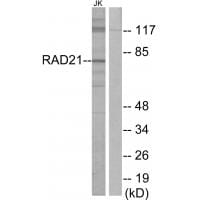 Western blot analysis of extracts from Jurkat cells, using RAD21 antibody #34296.